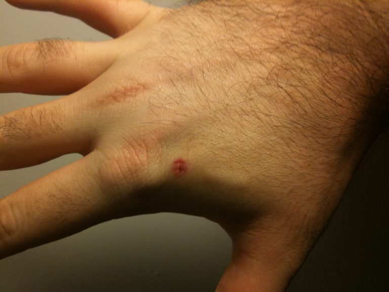 Three Square Market Becomes First US Company to Microchip Its Employees