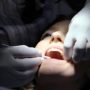 Dental Secrets You Need To Know