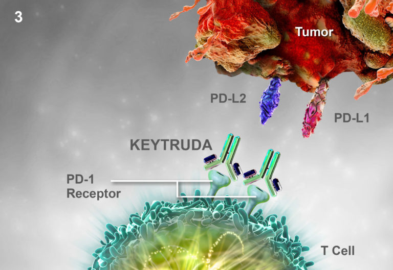 Pembrolizumab: Immunotherapy Drug Can Be Effective In Some Men with Advanced Prostate Cancer